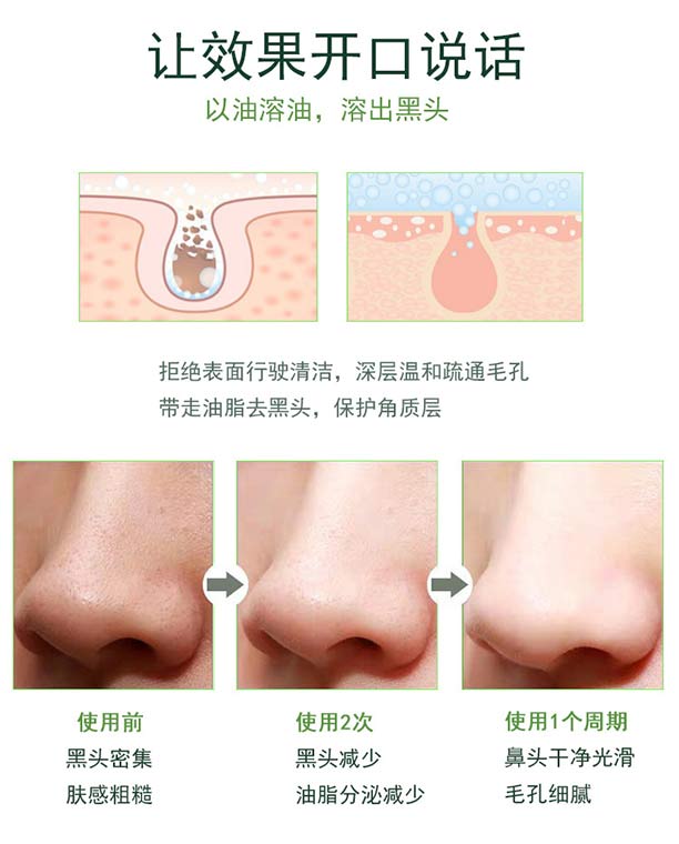 Ԋ�����ȥ���^�o�����b