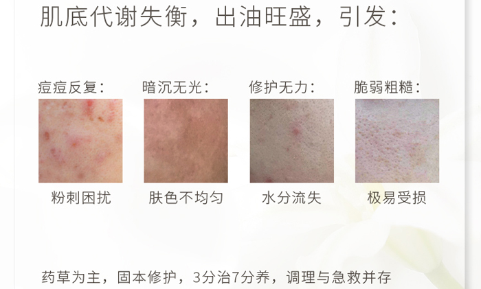 古璟妍舒緩修護(hù)精華液 古璟妍舒緩修護(hù)精華液